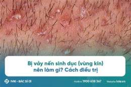 tính năng nổi bật vùng kín bị khô bong da có sao không